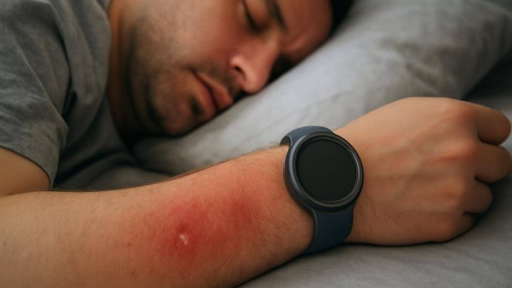 Galaxy Watch 5 Pro kullanıcısı uykuda yanık bildirdi
